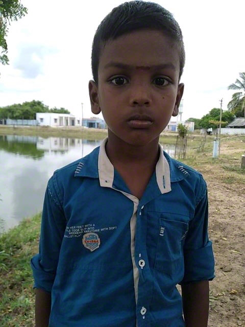 World Vision India